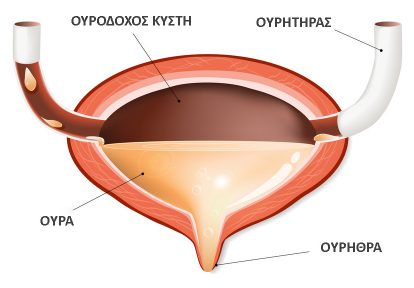 Ουροδοχος κυστη